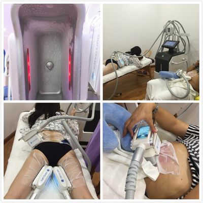 OSANO 2 handles double chin portable 360 degree cryolipolyse cool shaping beauty equipment