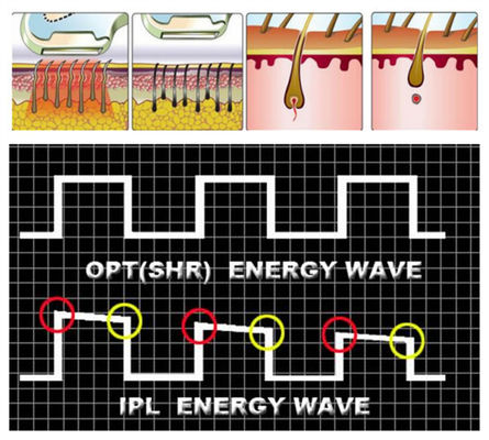 Máquina del retiro del pelo del OPT SHR IPL de la estética