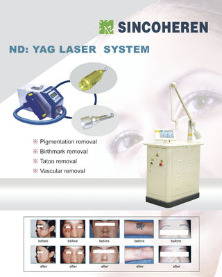 Maszyny do usuwania tatuaży Laser, Laser Monalisa Mole i plamka Removal