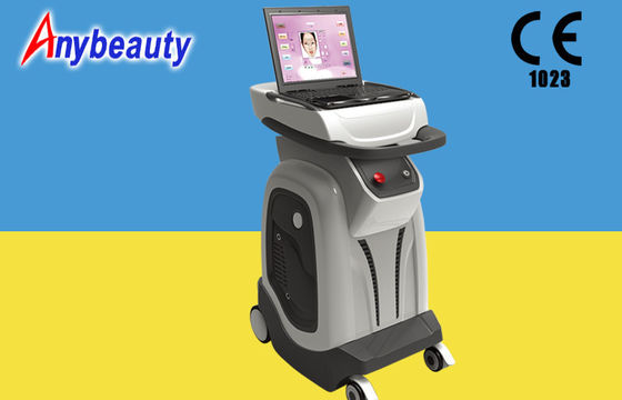 1550 nm Erbium Glass Fractional Laser Remove nevus zygomaticus