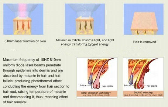 удаление волос лазера диода 808nm/лазера диода/постоянное удаление волос