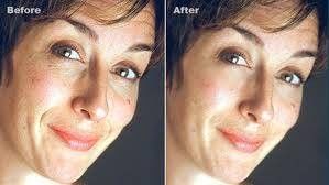 Portable Radio Frequency Skin Beauty Tightening Machine with Circle Water-cooling System