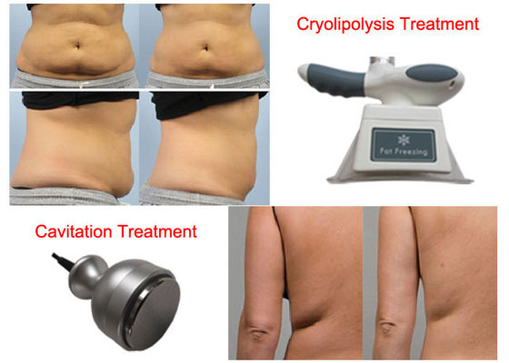Taşınabilir Çok Fonksiyonlu Lipo Masaj Makinesi, Cryo Fat RF Güzellik Ekipmanları Eritme