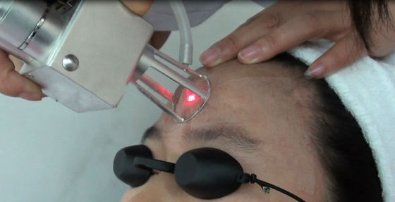 Hầu hết các chi tiết: 10600nm chuyên nghiệp bằng laser co2 fractional