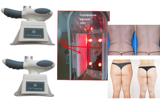 Machine ultrasonique d'enlèvement de cellulites de cavitation de vide vertical à la maison