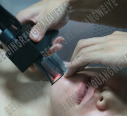 50Hz RF Tube Co2 Fractional Laser Machine For Skin Resurfacing